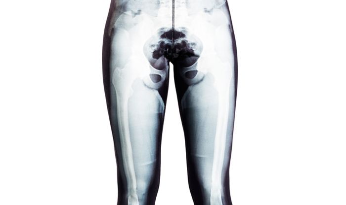 Креативные женские лосины с рисунком рентгеновского снимка